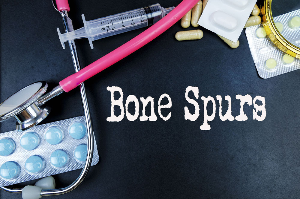 Bone Spurs – Causes, Types, and Management Options